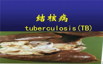 防治结核病日活动总结6篇