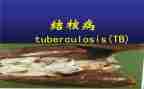 防治结核病日活动总结6篇